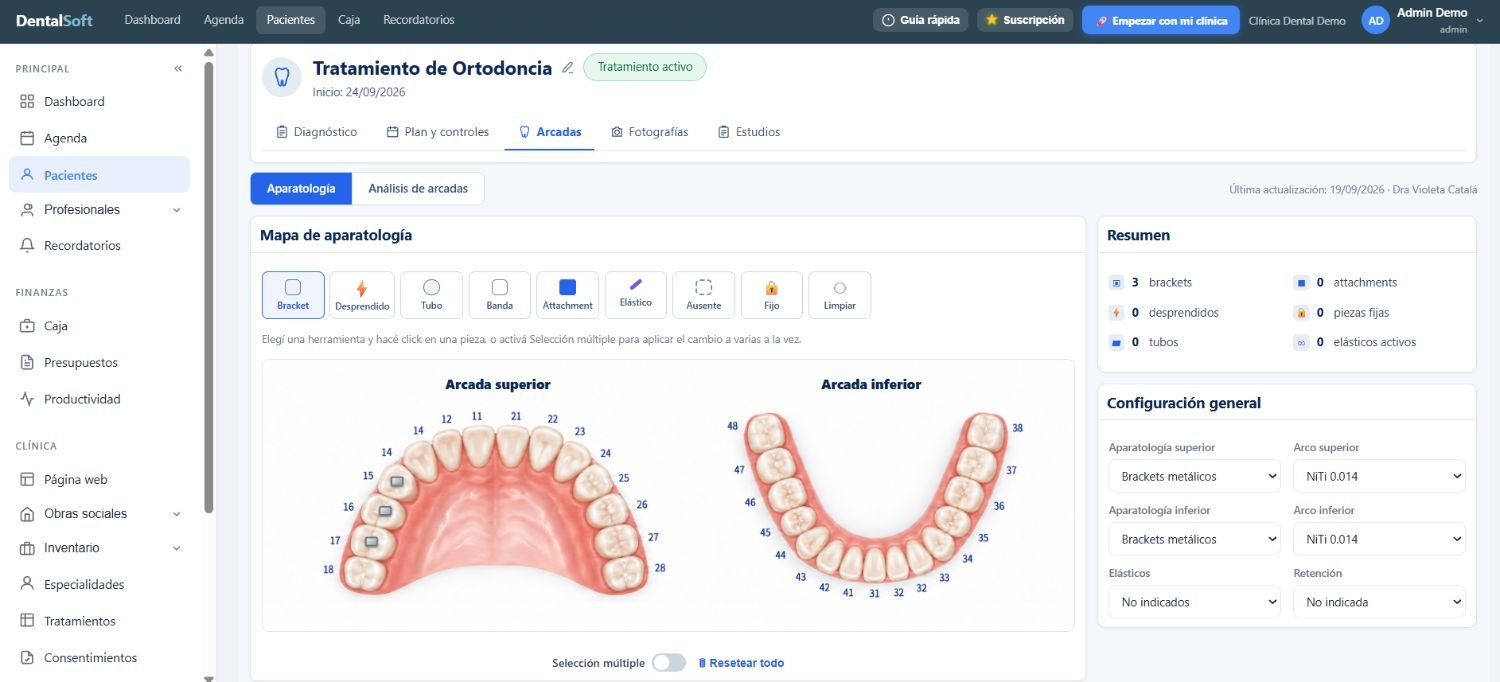 DentalSoft orthodontics module: an appliance map of the upper and lower arches with brackets, plus a summary and general configuration panel